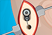 Operate Now: Ear Surgery