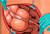 Appendix Surgery